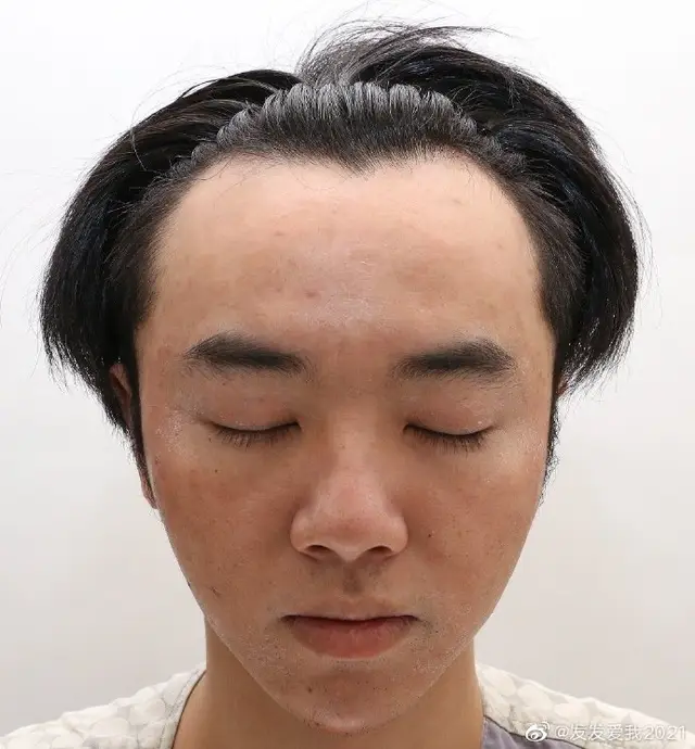 华晨宇整容_娱乐圈没整过容的明星_刘恺威整容后遗症