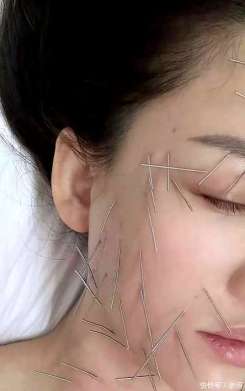 美容针在线观看仔仔网_美容针在线观看仔仔网_美容针在线观看仔仔网